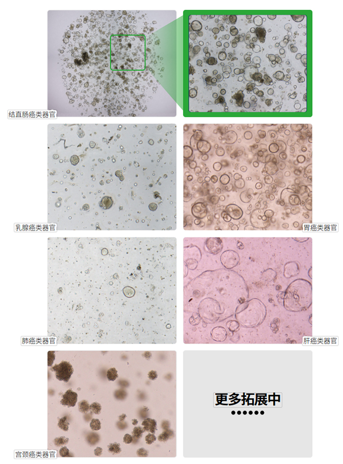 Countstar Castor S系列高通量智能3D细胞分析仪 - 不断拓展的类器官分析类别